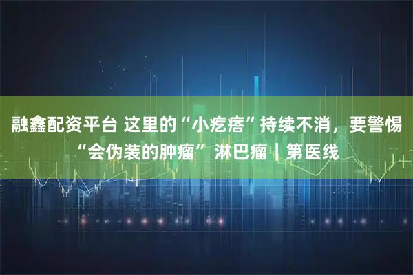 融鑫配资平台 这里的“小疙瘩”持续不消，要警惕“会伪装的肿瘤” 淋巴瘤｜第医线