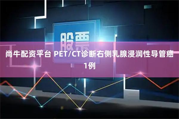 尚牛配资平台 PET/CT诊断右侧乳腺浸润性导管癌1例